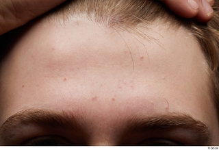 HD Face Skin Casey Schneider eyebrow face forehead skin pores…